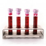 blood test and computerized analysis